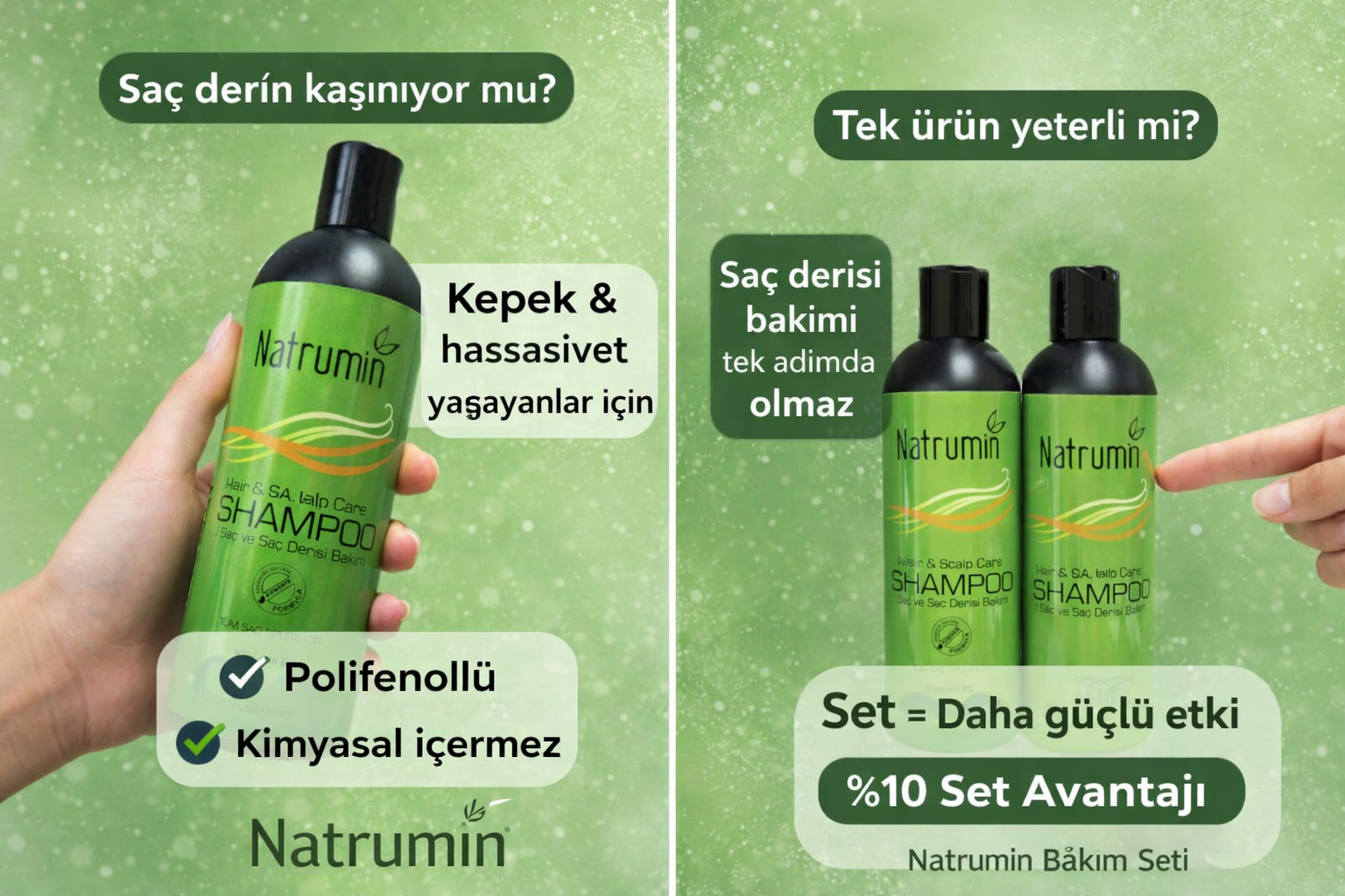 Siyah Şampuan Farkını Ortaya Koydu!